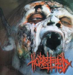 Paracoccidioidomicosisproctitissarcomucosis : 3-Way Split Paracoccidioidomicosisproctitissarcomucosis : 3-Way Split